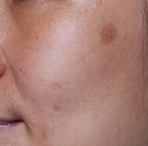 Before/After Image